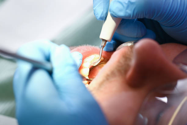 Best Pediatric Emergency Dentist in Barrett, TX