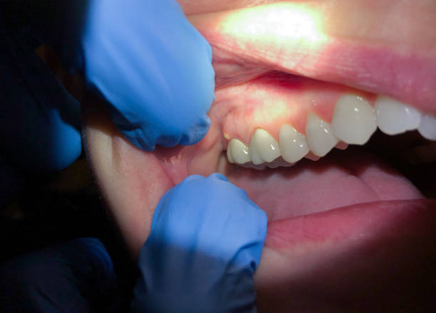 Best After-Hours Dental Trauma Care in Barrett, TX