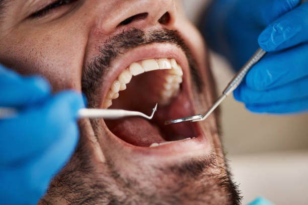 Best Same-Day Emergency Dental Services in Barrett, TX
