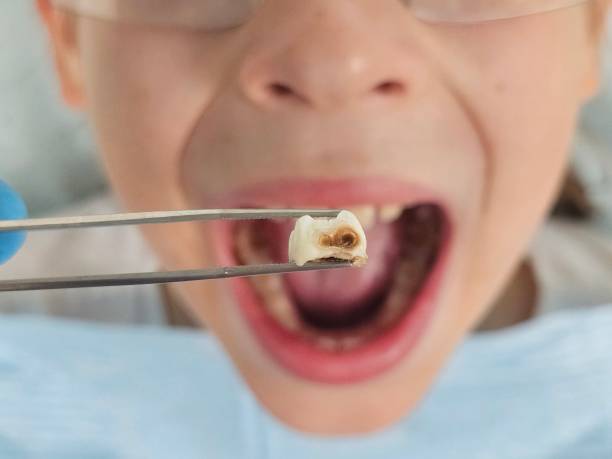 Best Same-Day Emergency Dental Services in Barrett, TX