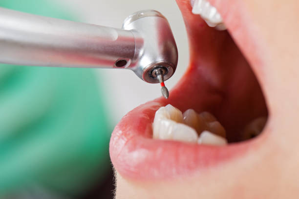 Best Same-Day Emergency Dental Services in Barrett, TX